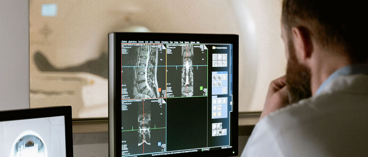A health care professional reviews images of an MRI
